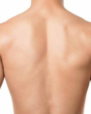 Media Espalda Hombres - Depilación Láser