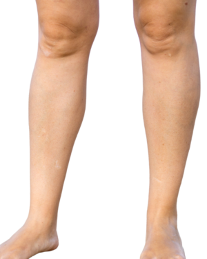 Media Pierna Hombres - Depilación Láser