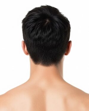 Nuca Hombres - Depilación Láser