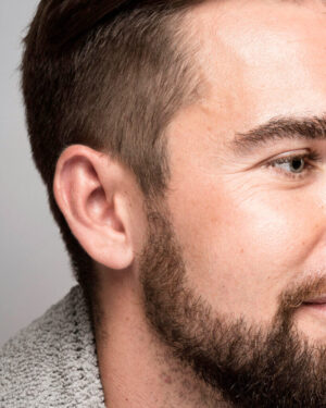 Patillas Hombres - Depilación Láser