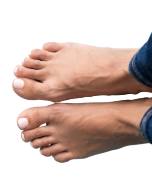 Pies Completos Hombres - Depilación Láser