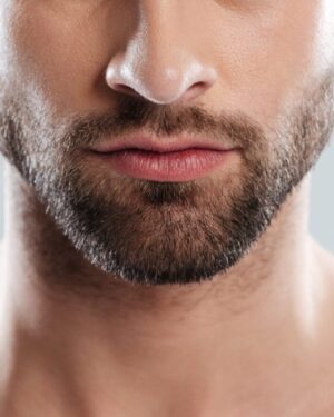 Labio superior Hombres - Depilación Láser