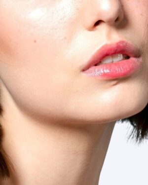 Borde maxilar Mujeres - Depilación Láser