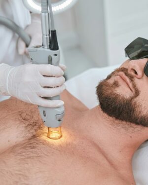 Depilación Láser Hombre